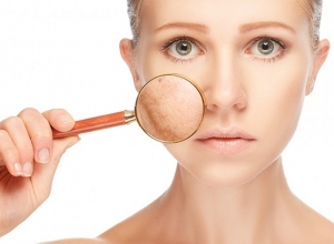 Giải đáp: Nám da có chữa khỏi không?